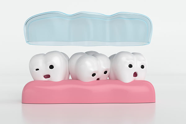 Commonly Asked Questions About Tooth Jewelry - Aces Braces